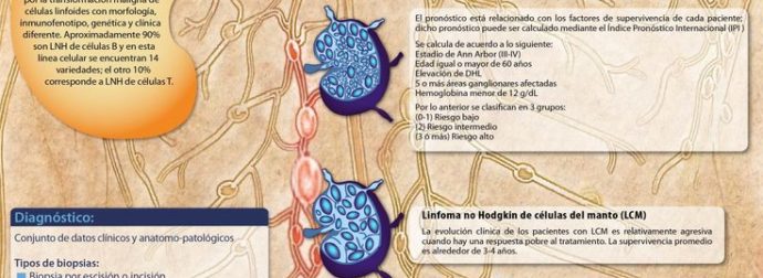 #Infografia #Salud #Linfoma #Synaptic – #Infografia #Alzheimer #Demencias