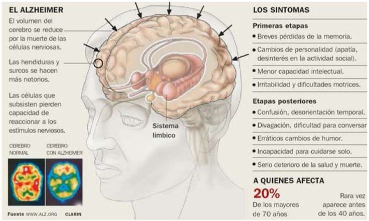 Infografia alzheimer laredinformacion | Pearltrees