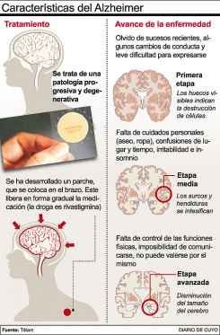 Características de la Enfermedad de Alzheimer