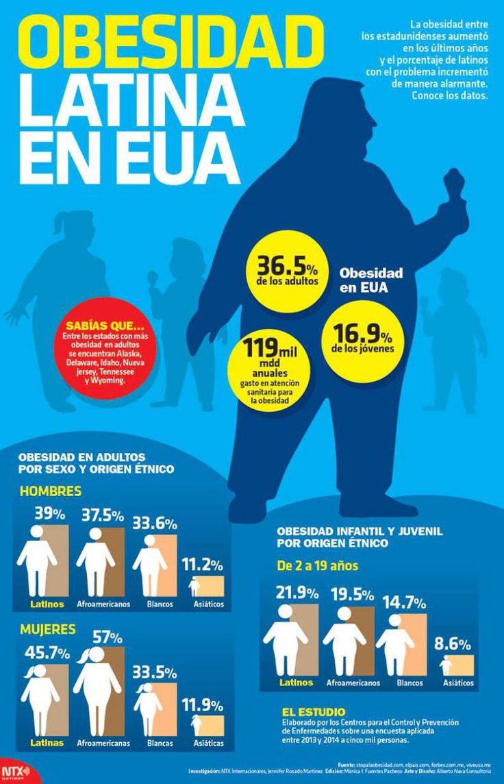 #Infografía Obesidad Latina en Estados Unidos