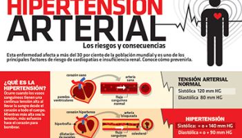 #Infografia Virus del papiloma humano, qué es y cómo prevenirlo