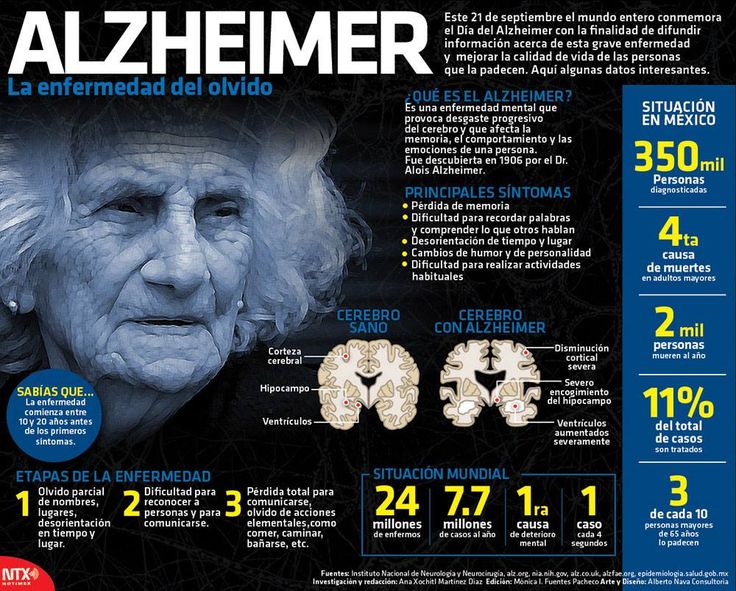 #Infografia Alzheimer