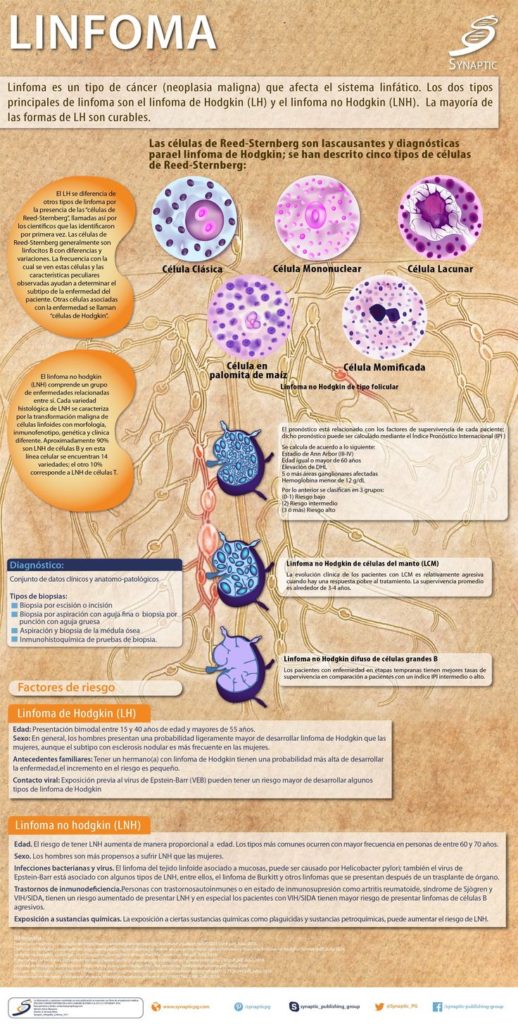 #Infografia #Salud #Linfoma #Synaptic