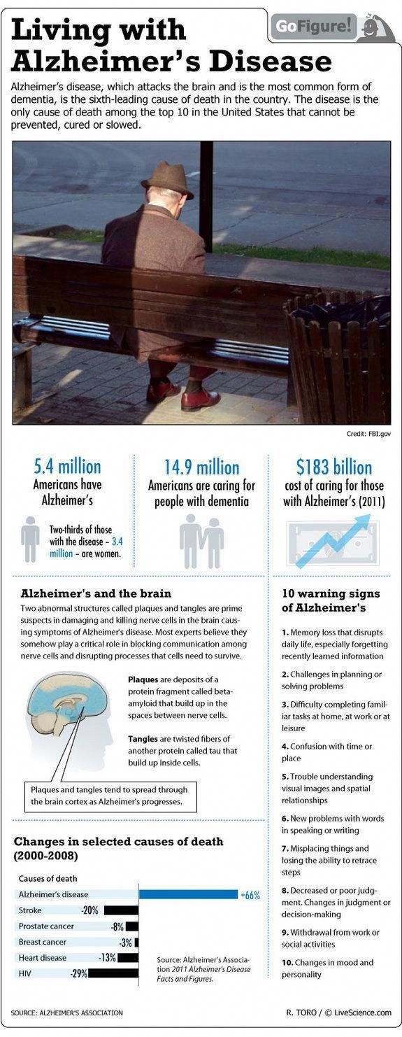 Living With Alzheimer's in the U.S. (Infographic)