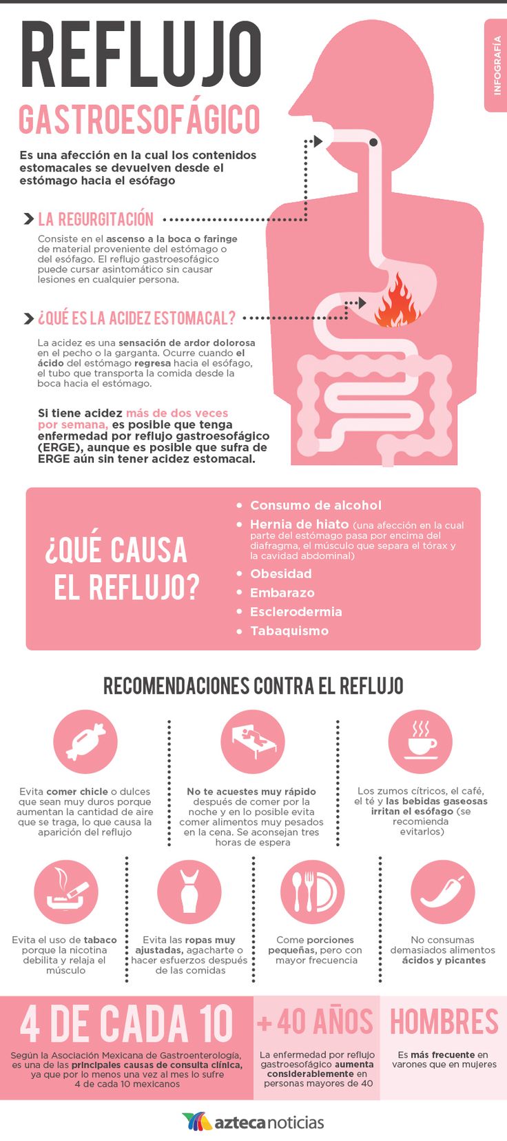 Reflujo gastroesofágico #infografia