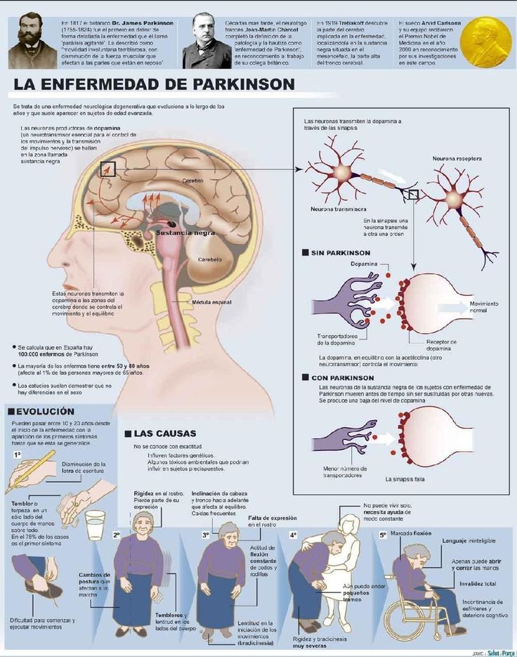 #Salud 11 de abril, Día Internacional del Mal de Parkinson. Efeméride busca co...