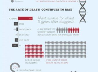 Alzheimers Epidemic Infographic – #Infografia #Alzheimer #Demencias