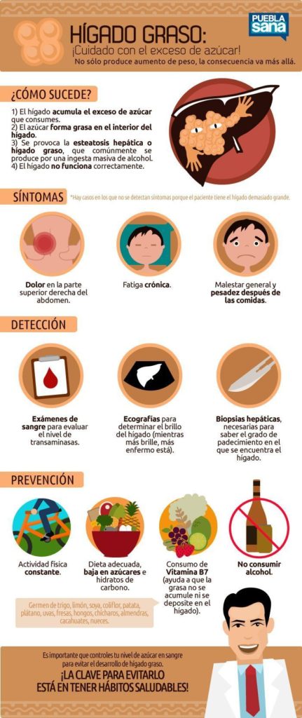 Hígado graso: Síntomas, tipos y prevención