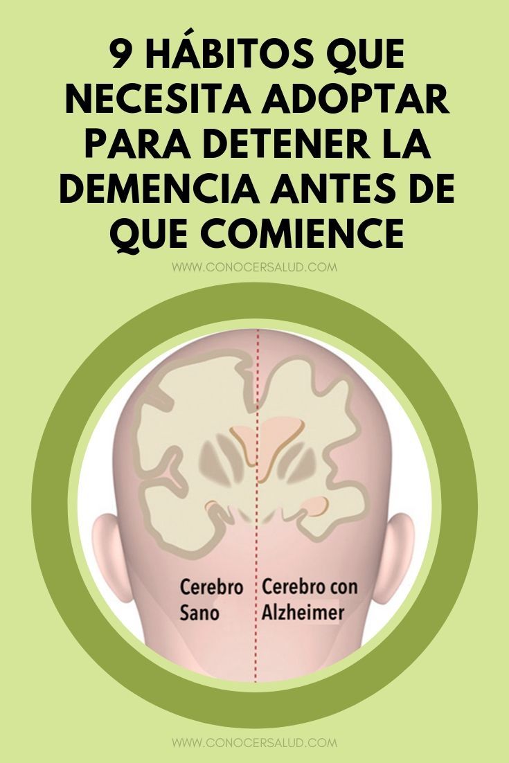 9 hábitos que necesita adoptar hoy para detener la demencia o el mal de Alzheim...