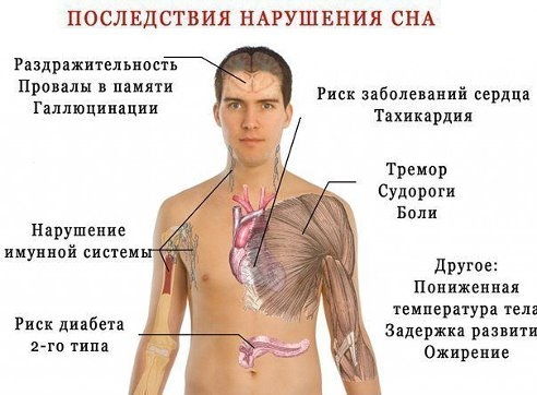 8 Последствий нарушения сна. 0