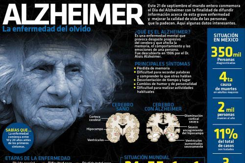 #Infografia Alzheimer