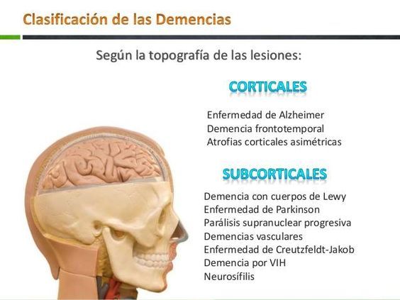 La demencia senil puede ser prevenida, te enseñamos cómo