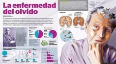 infografia alzheimer