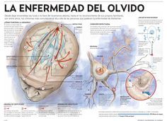 Alzheimer – la enfermedad del olvido #infografia #infographic ...