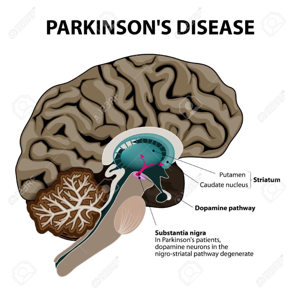 CDB en Parkinson