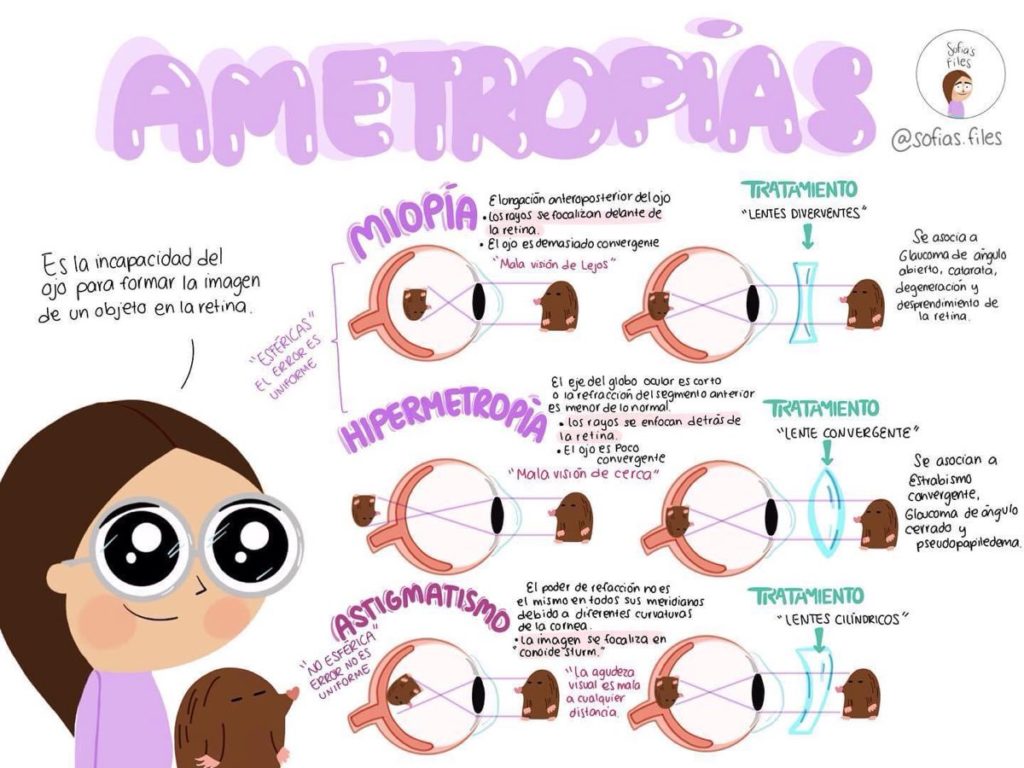 Ametropías