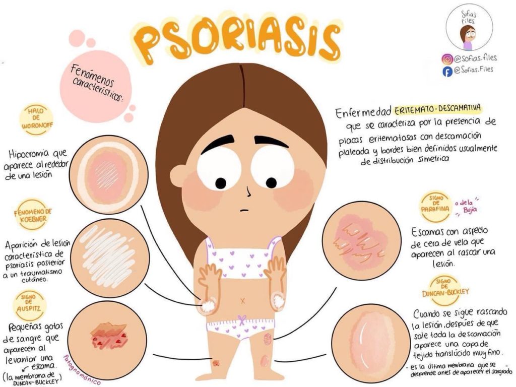 Psoriasis