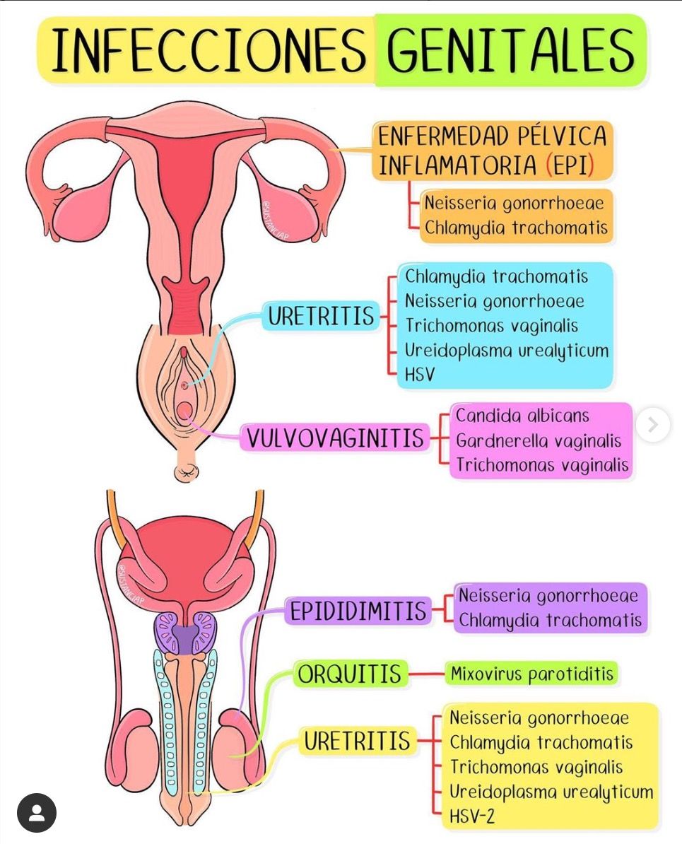 Infecciones genitales (1)