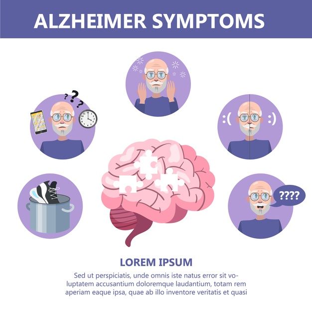 Infografía De Síntomas De La Enfermedad De Alzheimer. Pérdida Y Problema De Memoria