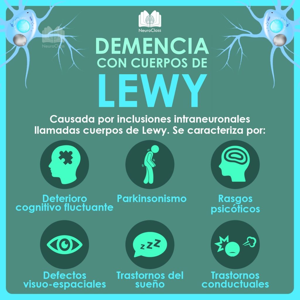 Demencia con cuerpos de Lewy