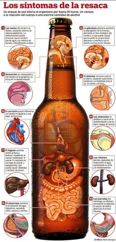 Los síntomas de la resaca #infografia #infographic