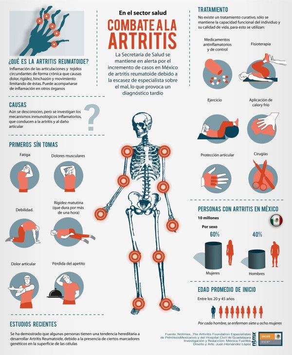 Artritis reumatoide #infografia #inographic #health