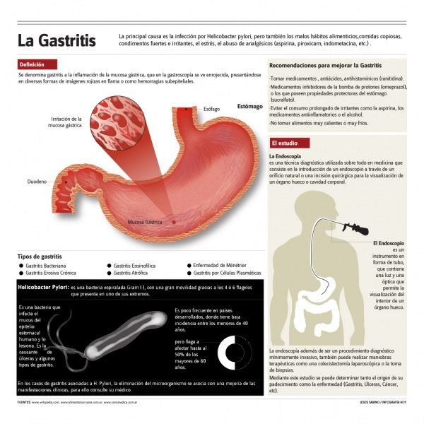 La gasrtritis #infografia #infographic #salud