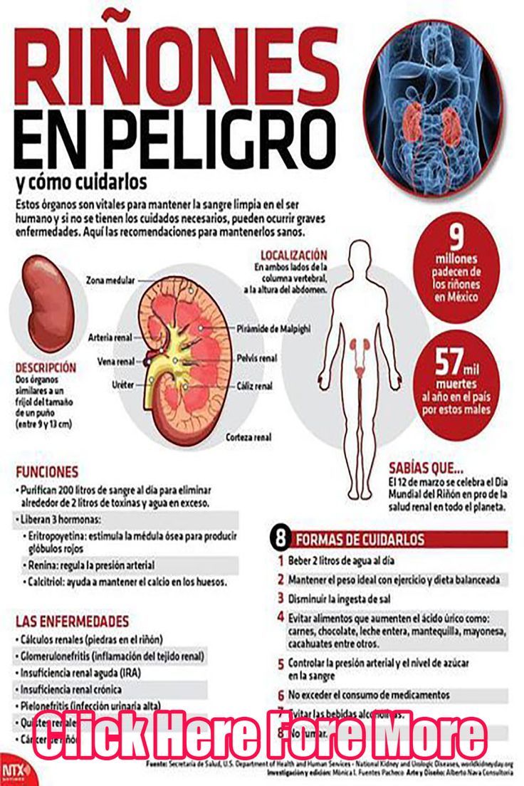 Infografia Riones en peligro y cmo cuidarlos