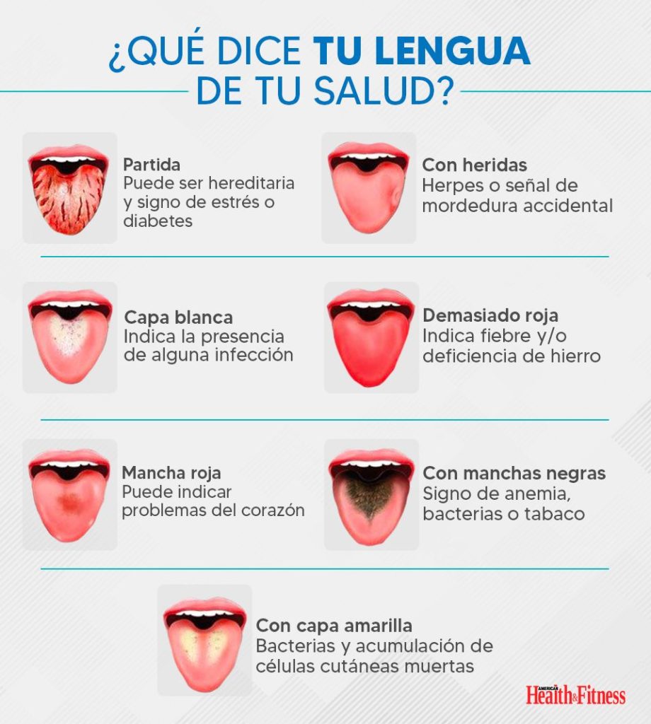 ¿Qué dice tu lengua de tu salud?