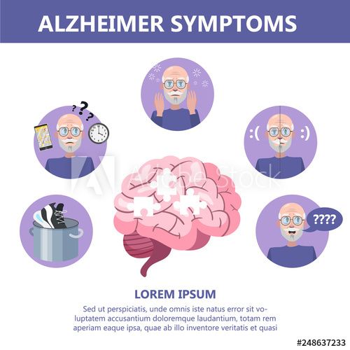 Alzheimer disease symptoms infographic. Memory loss and problem