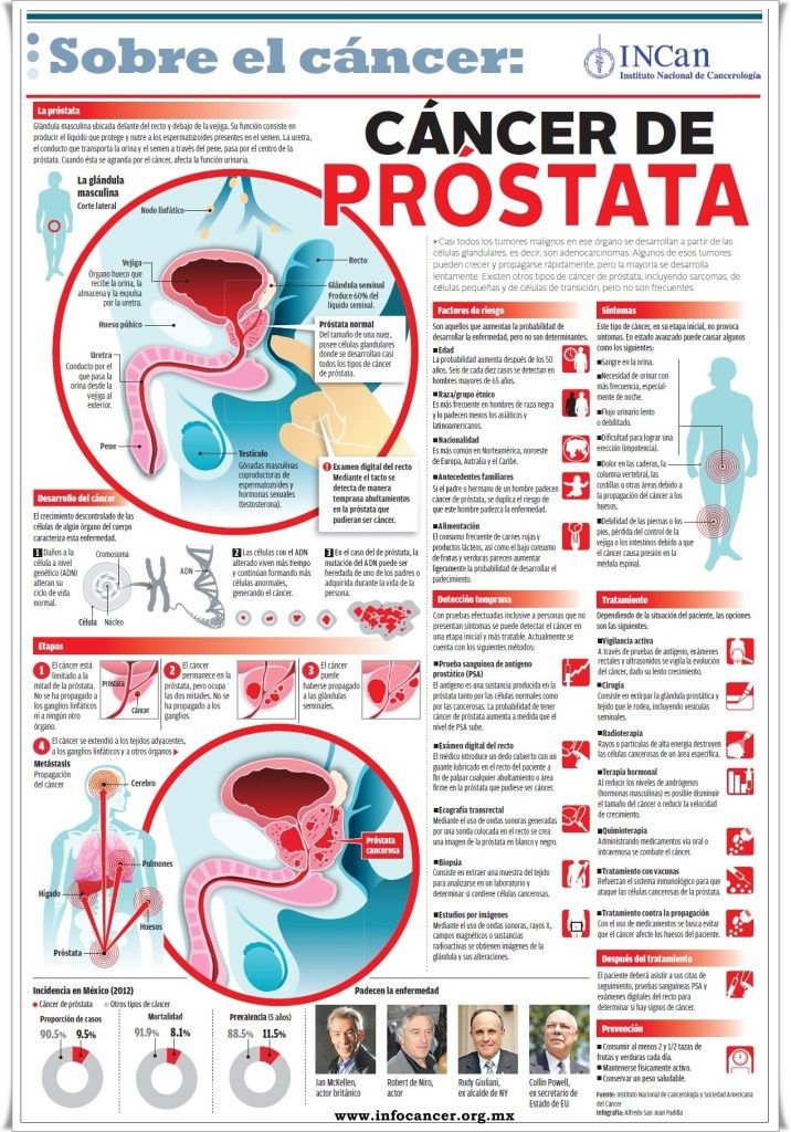 Infografía - Cáncer de Próstata - Blog del Dr. Juan Acuña