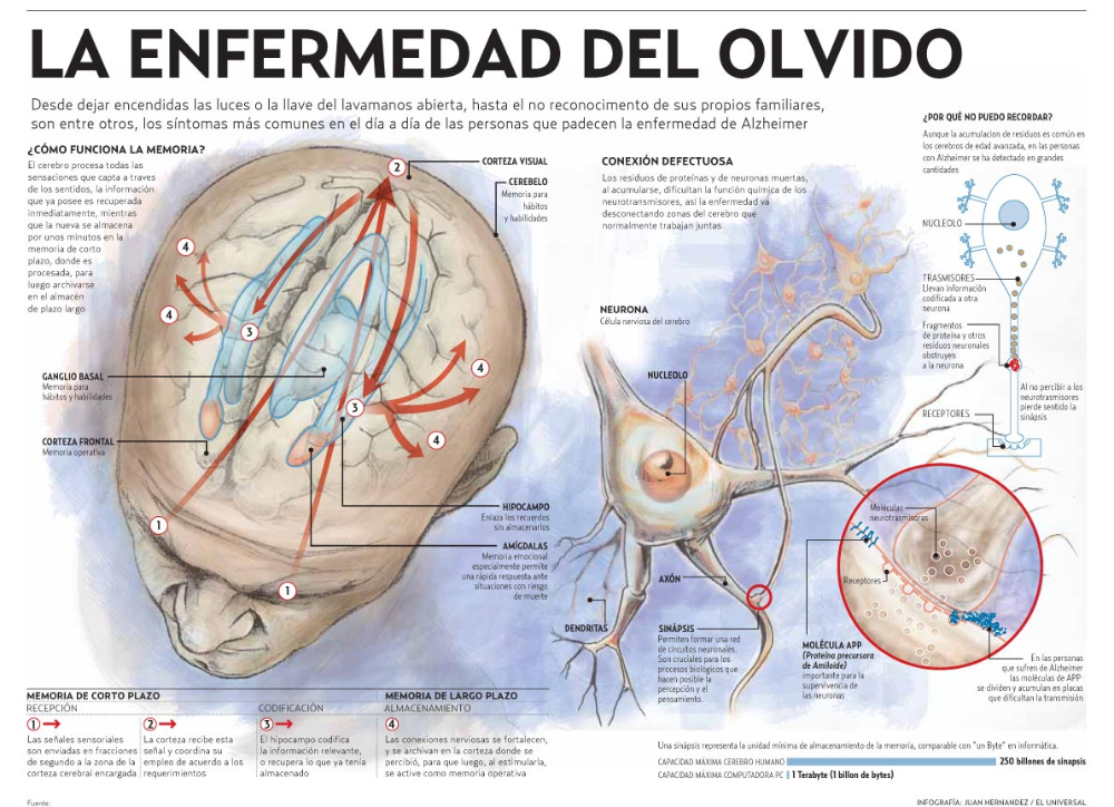 Asociación contra el Alzheimer | 1001Medios