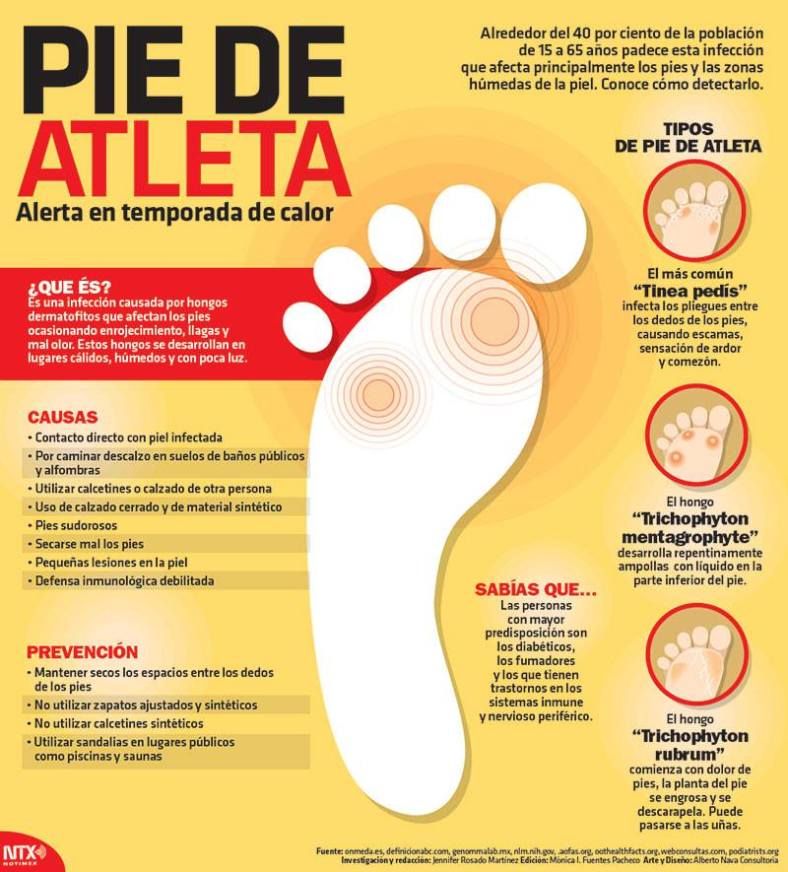 #Infografia Pie de atleta