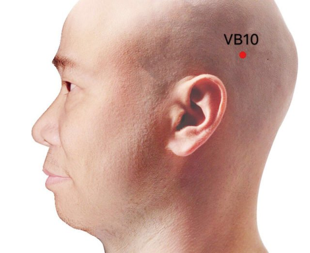 VB10 (Fubai) - Saludymedicinachina.com