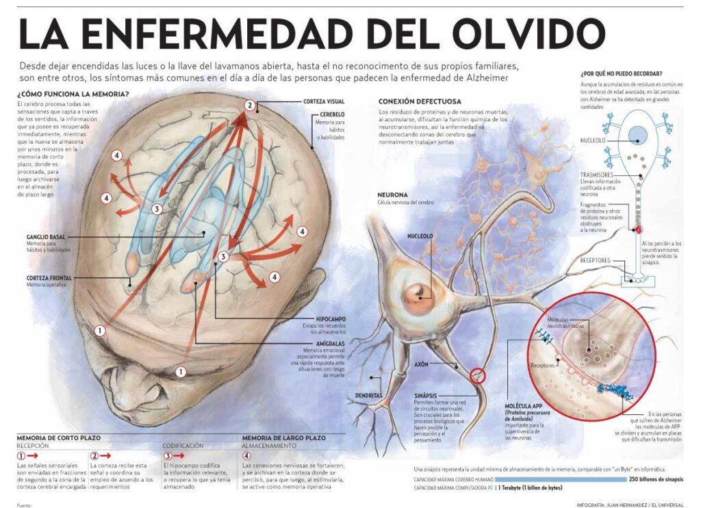 ¿Cómo sería tu cerebro con alzhéimer? [vídeo infografía]