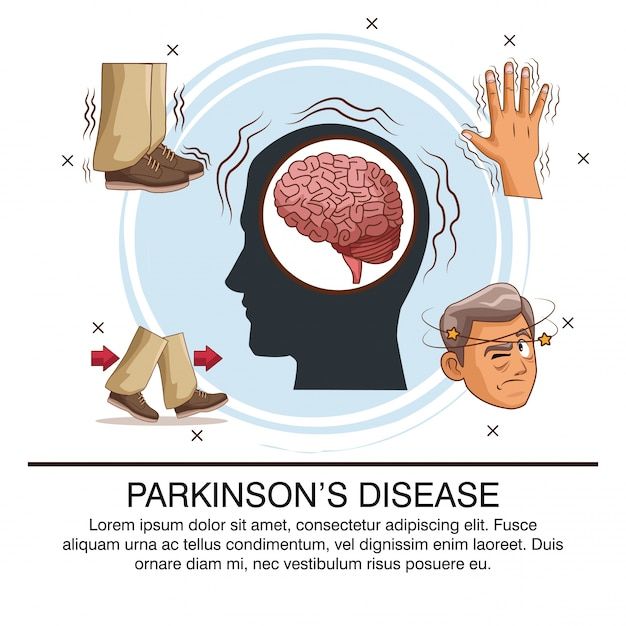 Enfermedad de parkinson infografía | Vector Premium