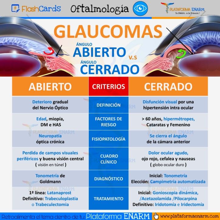 GLAUCOMAS ABIERTO V.S CERRADO 🩺