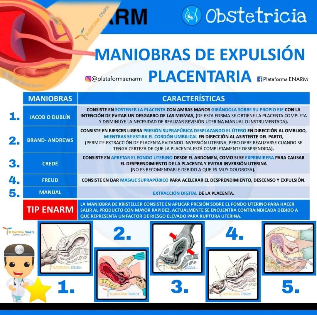 Maniobras de Expulsión Placentaria