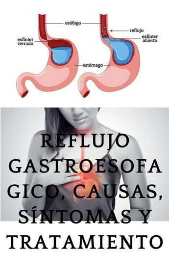 REFLUJO GASTROESOFAGICO, CAUSAS, SÍNTOMAS Y TRATAMIENTO