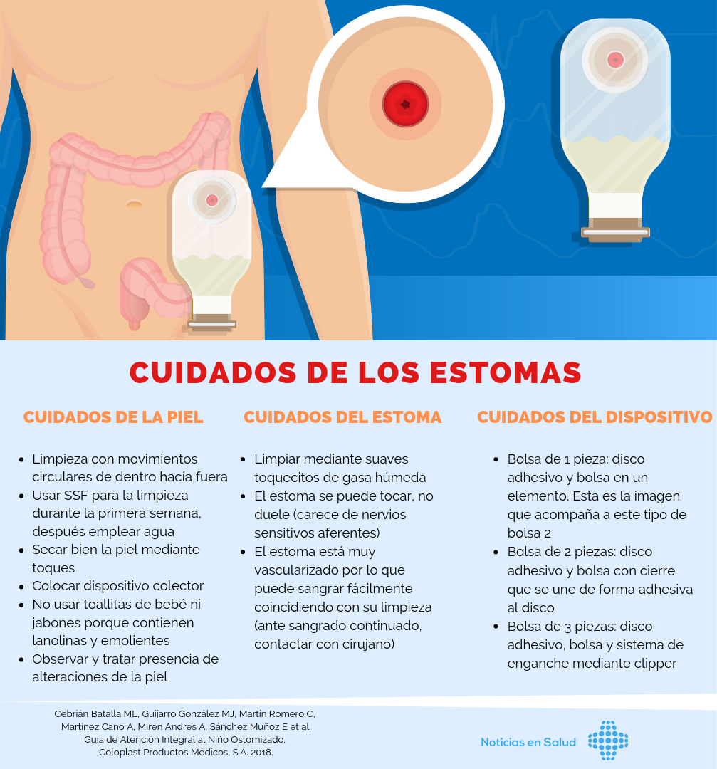 Infografías de Salud | Noticias en Salud