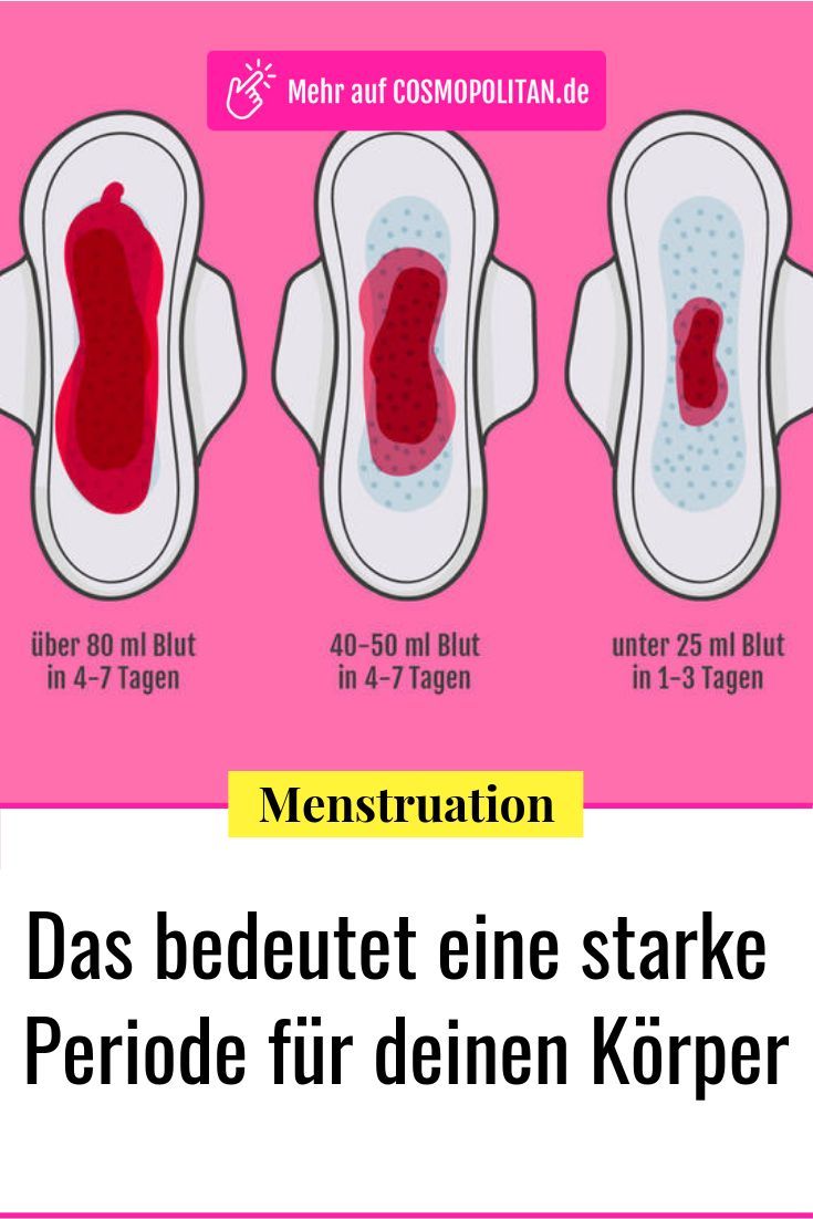 Periode: Was deine Menstruationsblutung über deine Gesundheit verrät