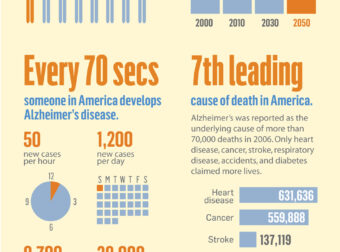 Alzheimers by the Numbers (Data Visualization) | Infographic design – #Infografia #Alzheimer #Demencias