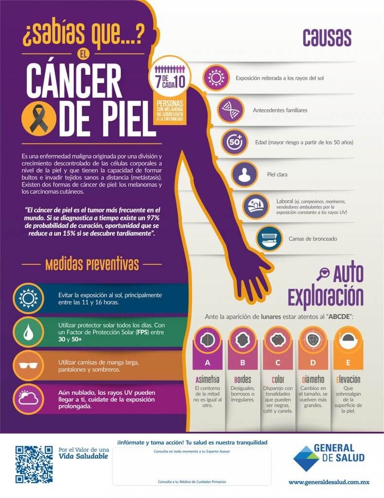 Cáncer de Piel