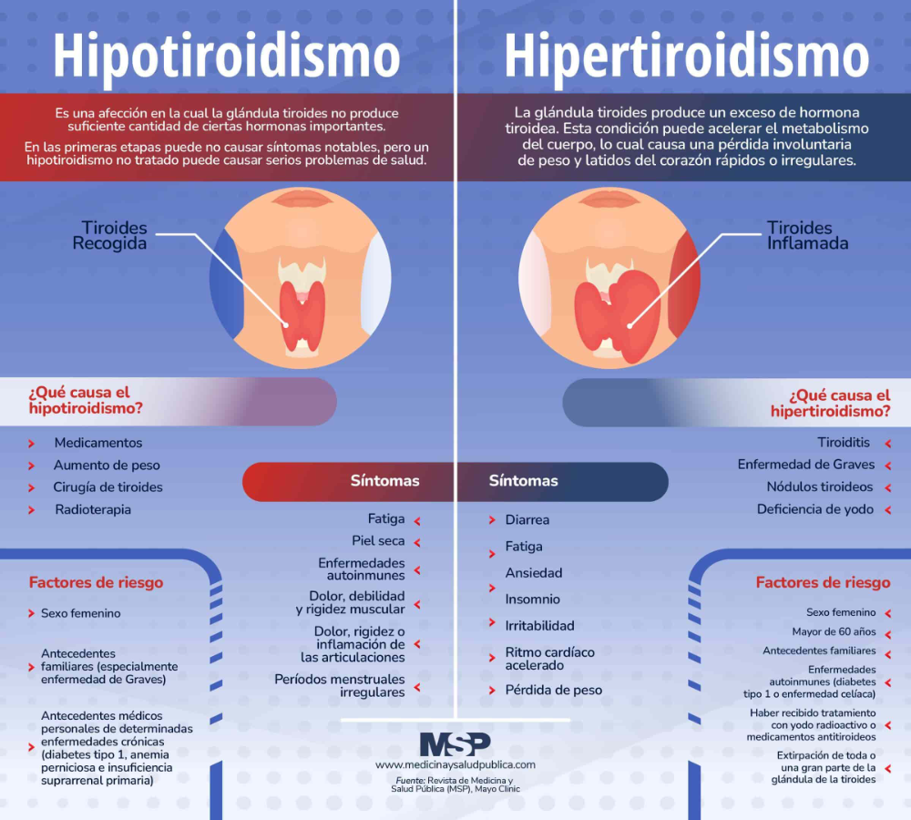 Hipotiroidismo vs Hipertiroidismo - Infografía